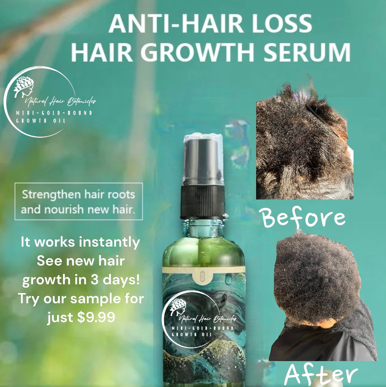 Merigoround alopecia hair growth oil